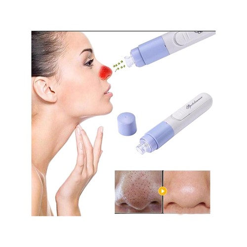 Aspiratore facciale elettrico - aspiratore,