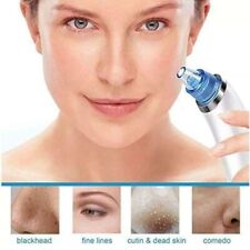 Aspira Aspiratore Rimuovi