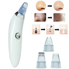 ASPIRA PUNTI NERI ASPIRATORE