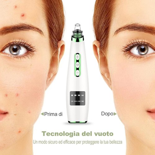 Aspiratore punti neri viso - aspiratore,