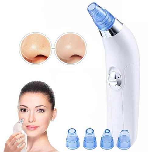 Aspiratore aspira rimuovi - aspiratore,